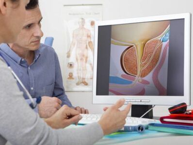 Un urólogo consulta ao paciente sobre a prostatite e os métodos para o seu tratamento.